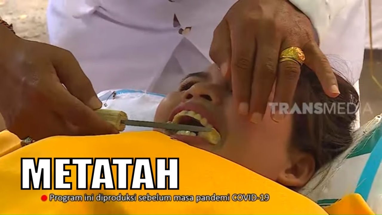 Tradisi METATAH, Ritual Potong Gigi di Bali | RAGAM INDONESIA (05/02/21)