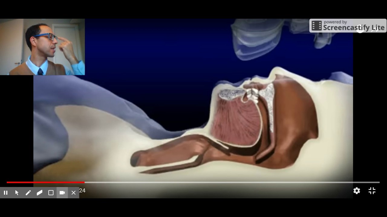 Como funciona CPAP - Aula MEDICO
