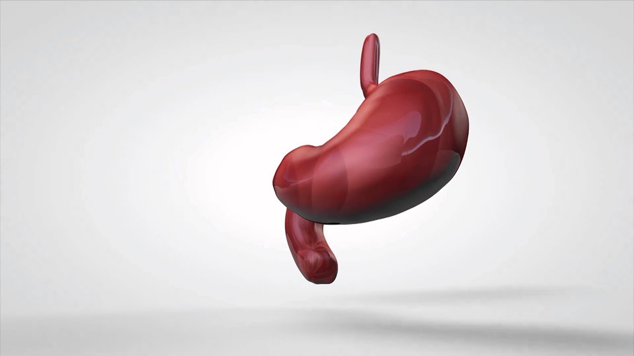 טיפול בהליקובקטר פילורי