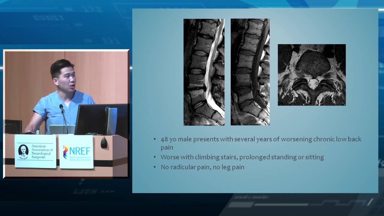 Evidence Based Medicine and Guidelines