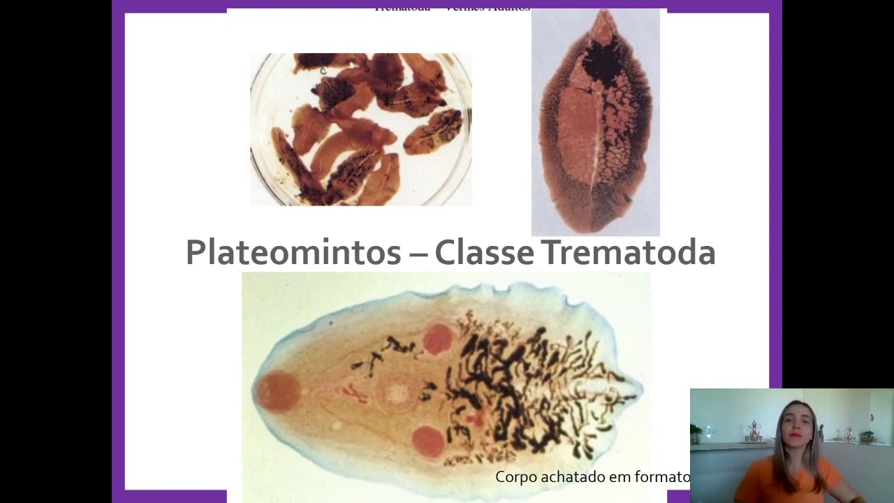 10.  Roteiro 10.  Parasitas Helmintos