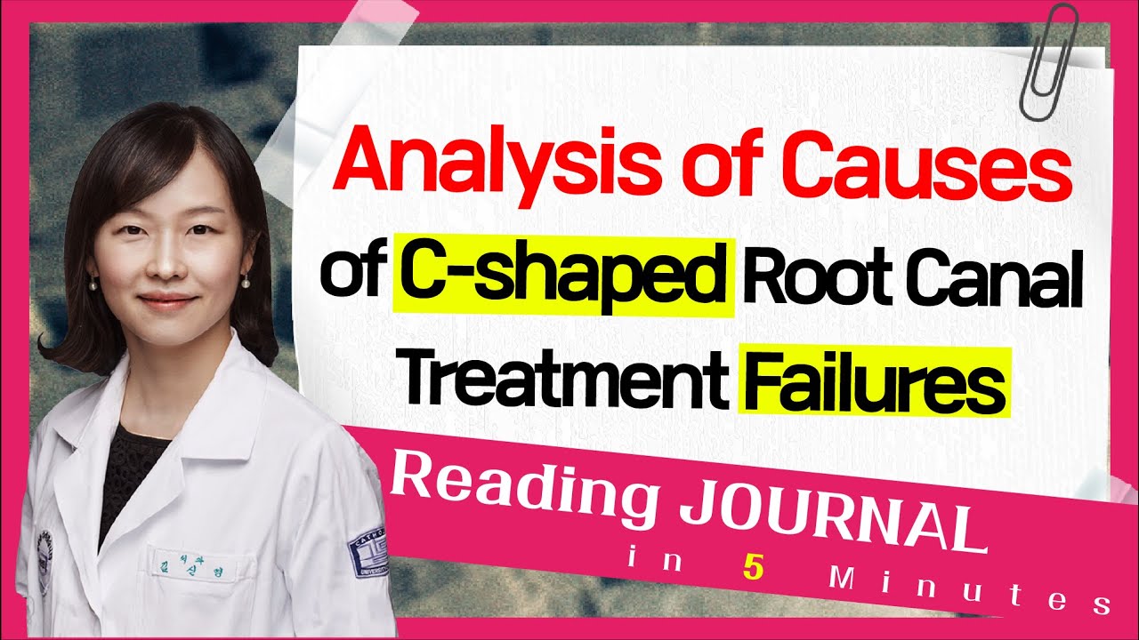 [Endodontics : 5 minutes summary] Analysis of Causes of C shaped Root Canal Treatment Failures