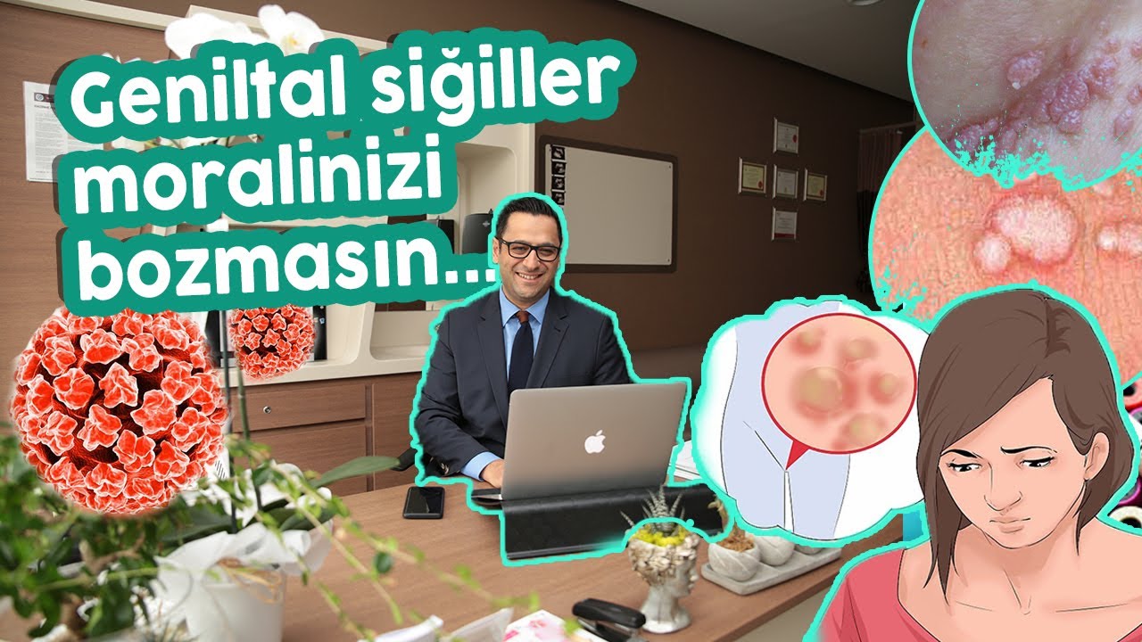 GENİTAL SİĞİL💥 TEDAVİSİ (Siğil nasıl bulaşır? Belirtileri nedir? Kesin tedavisi var mı? Siğil aşısı)