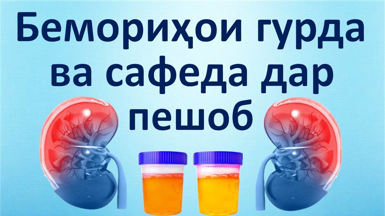 Гурда. Беморихои гурда ва сафеда дар пешоб.