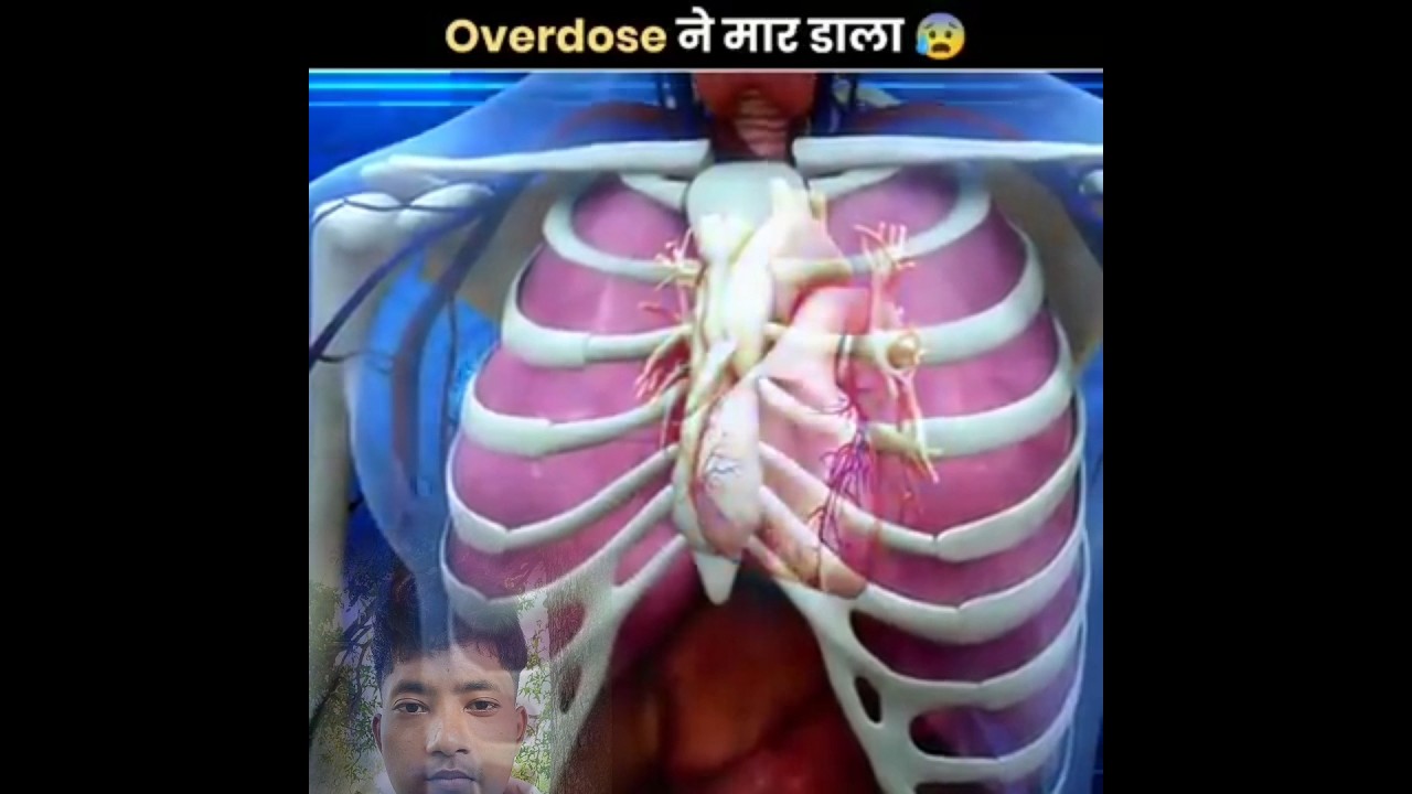 Worst Ways People Have Died 😰 | The fact editz | 