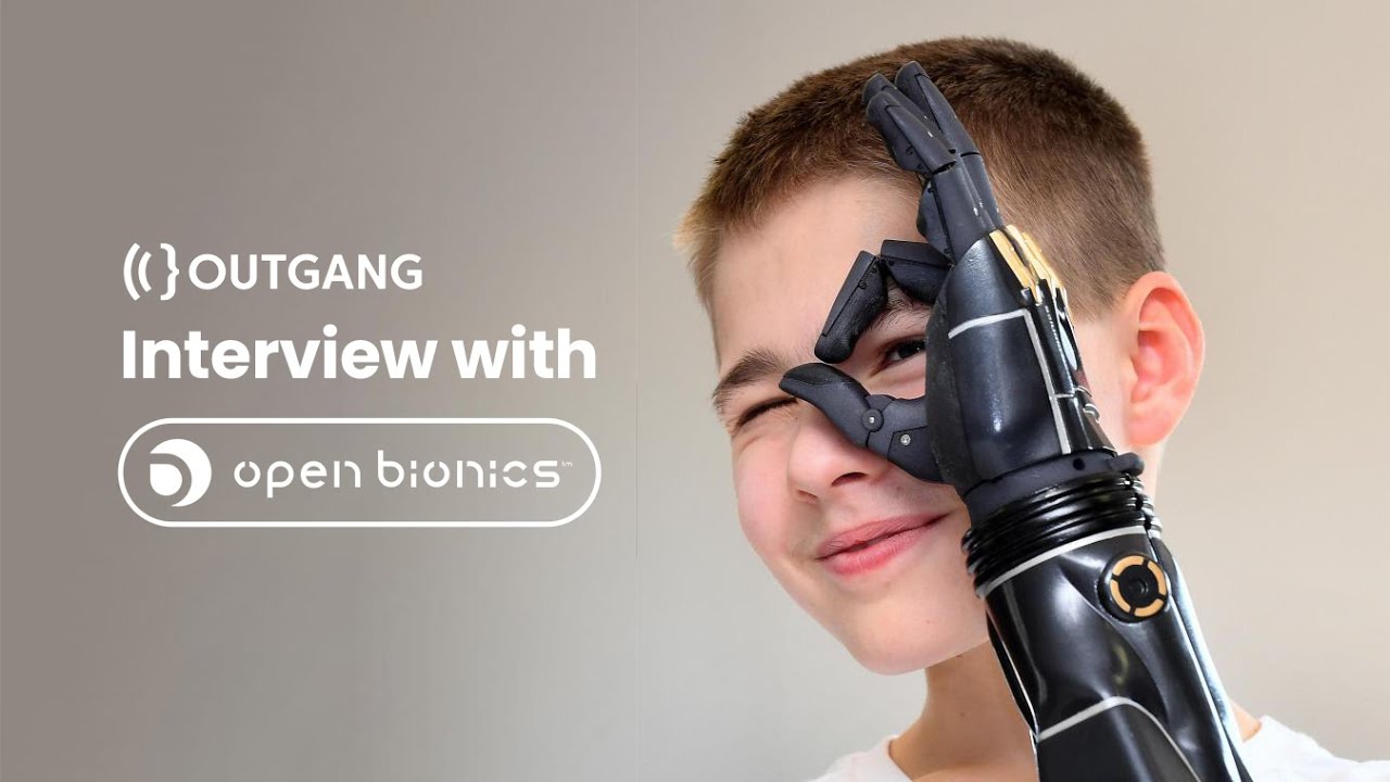 Using Blender and 3d Printing to Make Bionic Arms | Open Bionics Interview