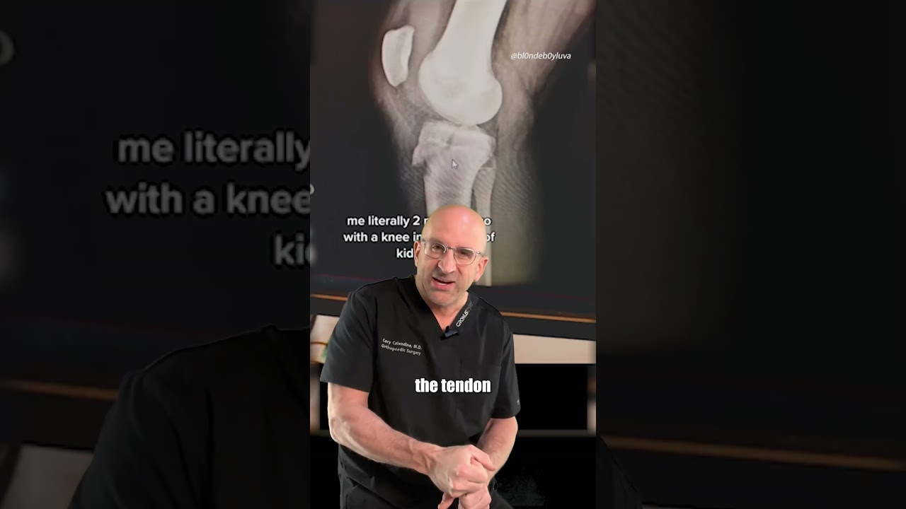Painful Avulsion Fracture in Teens (uncommon) #shorts