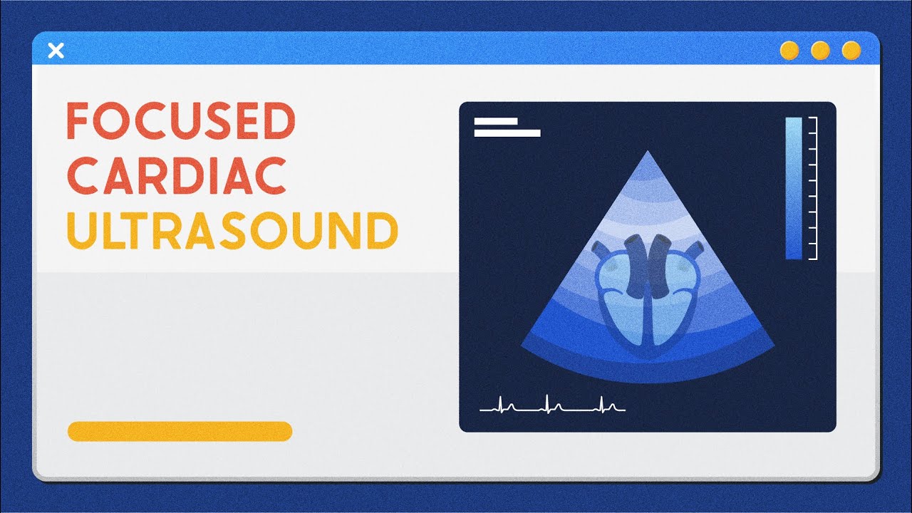 4. Right heart assessment