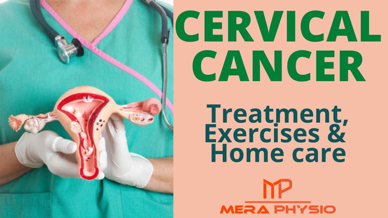 Cervical Cancer | Treatment, Exercises & Home Care for Cervical Cancer | In Hindi | Mera Physio