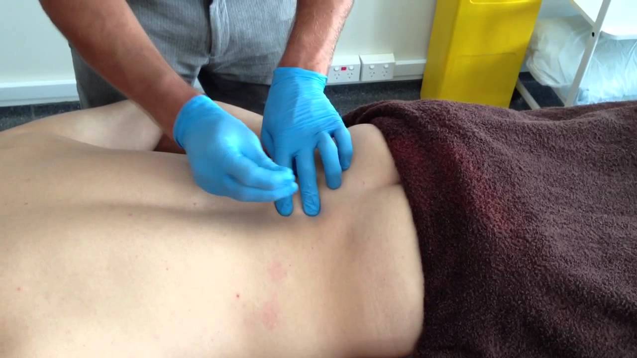 Dry Needling: Supraspinous Ligament