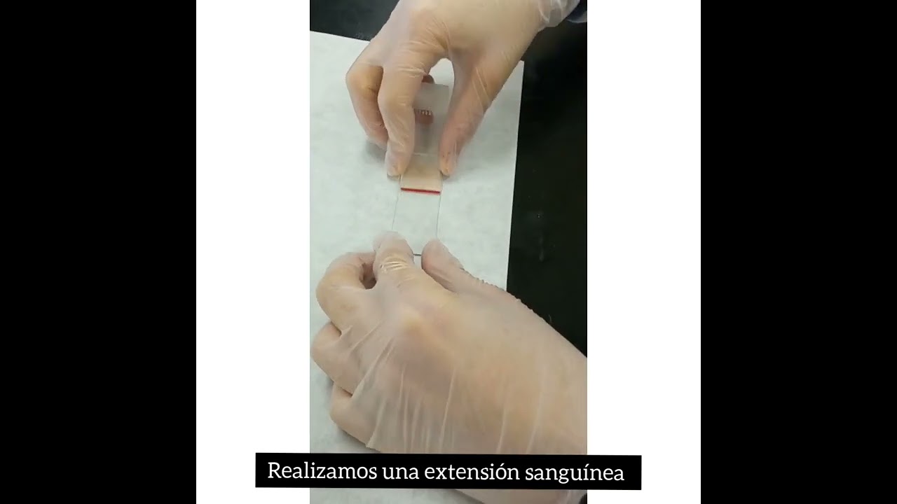 Tinci&oacute;n de Giemsa