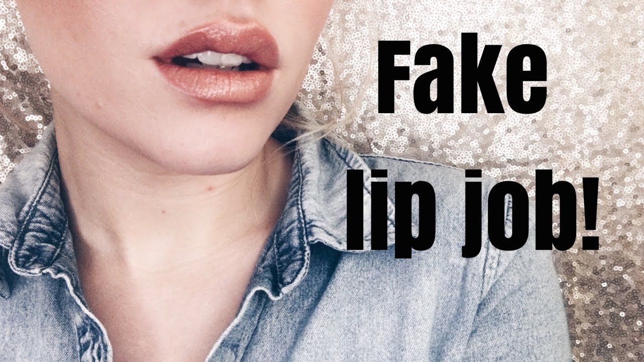 Juvederm free lip job!