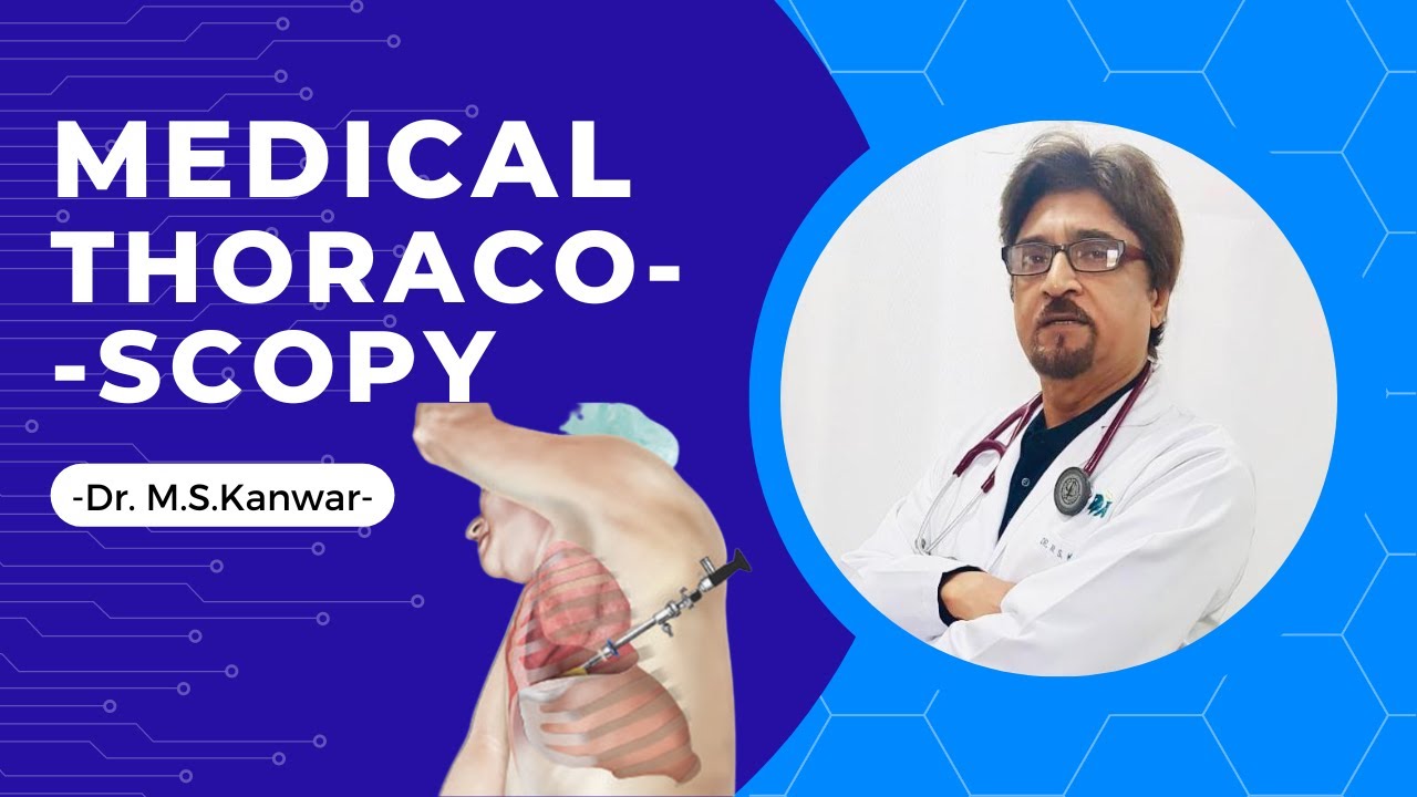 Medical Thoracoscopy I Pulmonologist I Dr. M.S.Kanwar