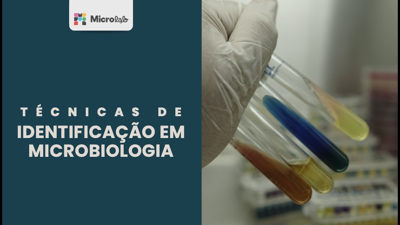 Como interpretar provas bioquímicas usadas na idenificação de bactérias?
