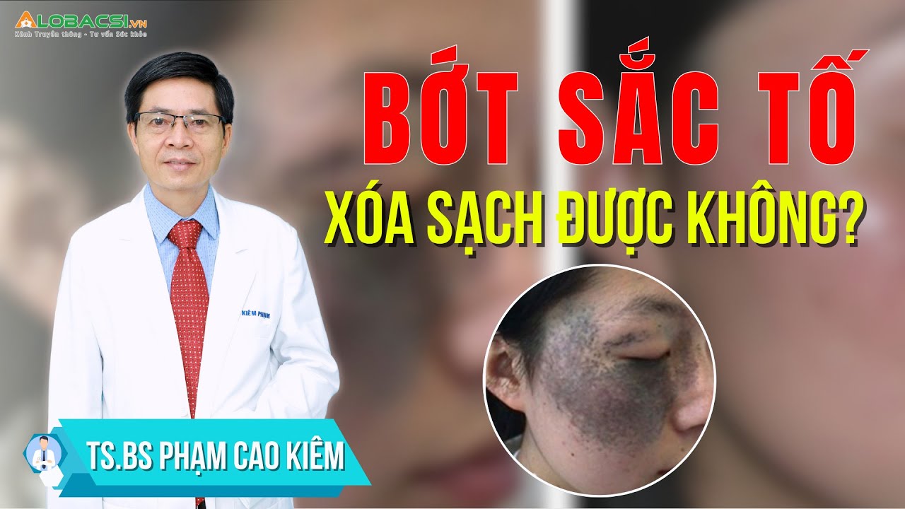Bớt sắc tố bẩm sinh, có cách nào xóa sạch?  | TS.BS Phạm Cao Kiêm
