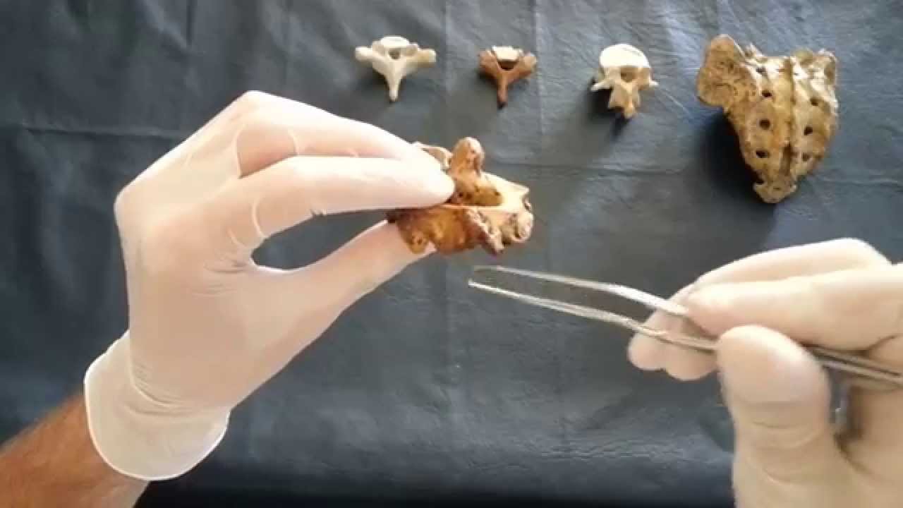 Osteología: Columna vertebral.
