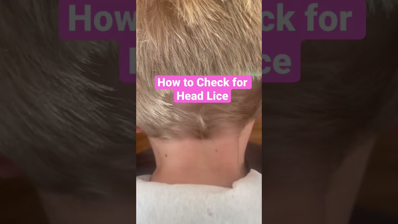 How to Check for Head Lice on Boys l Lice Infestation l Lice Removal Service