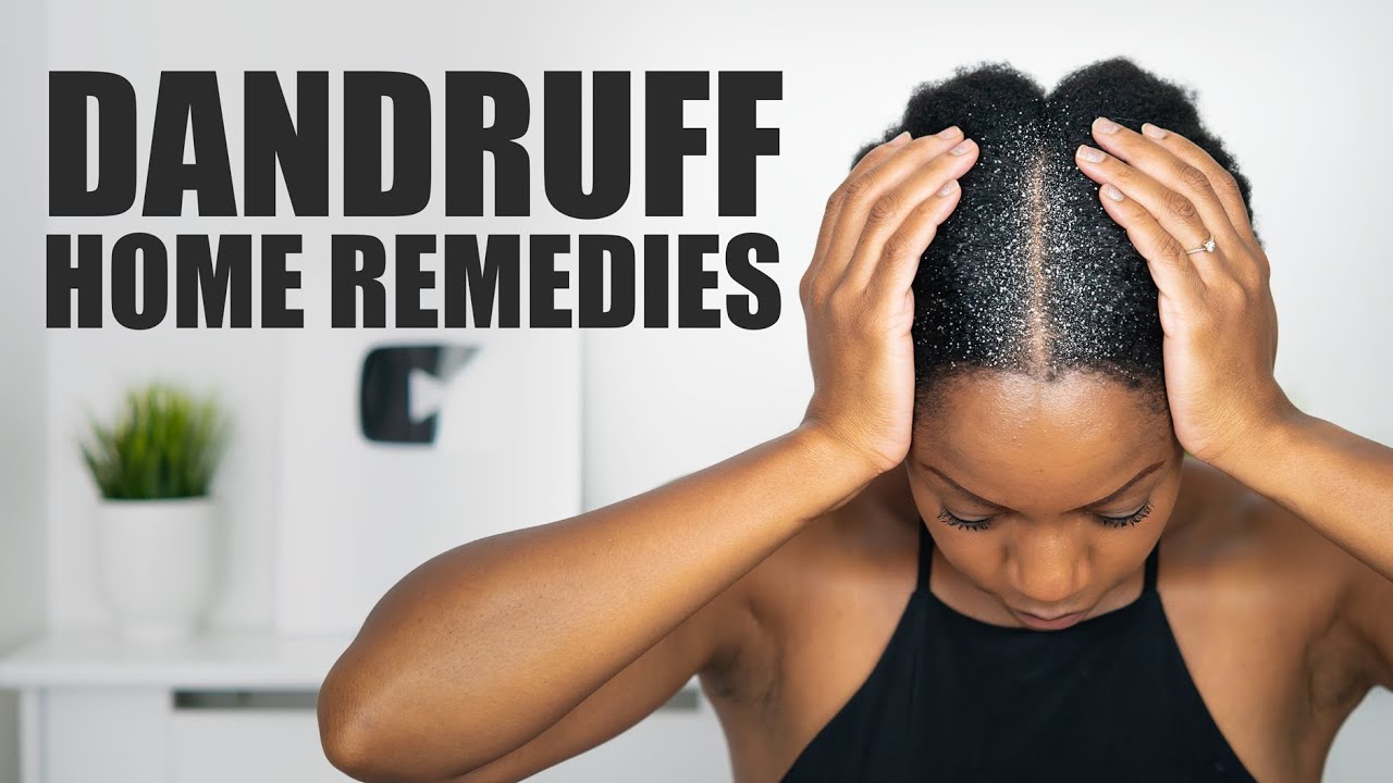8 HOME REMEDIES to FIGHT DANDRUFF!