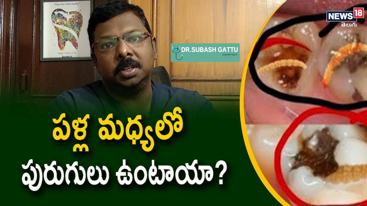 పళ్ల మధ్యలో పురుగులు ఉంటాయా? | Do you Really Need Teeth Worms ? | Dentist Tips | News18 Telugu