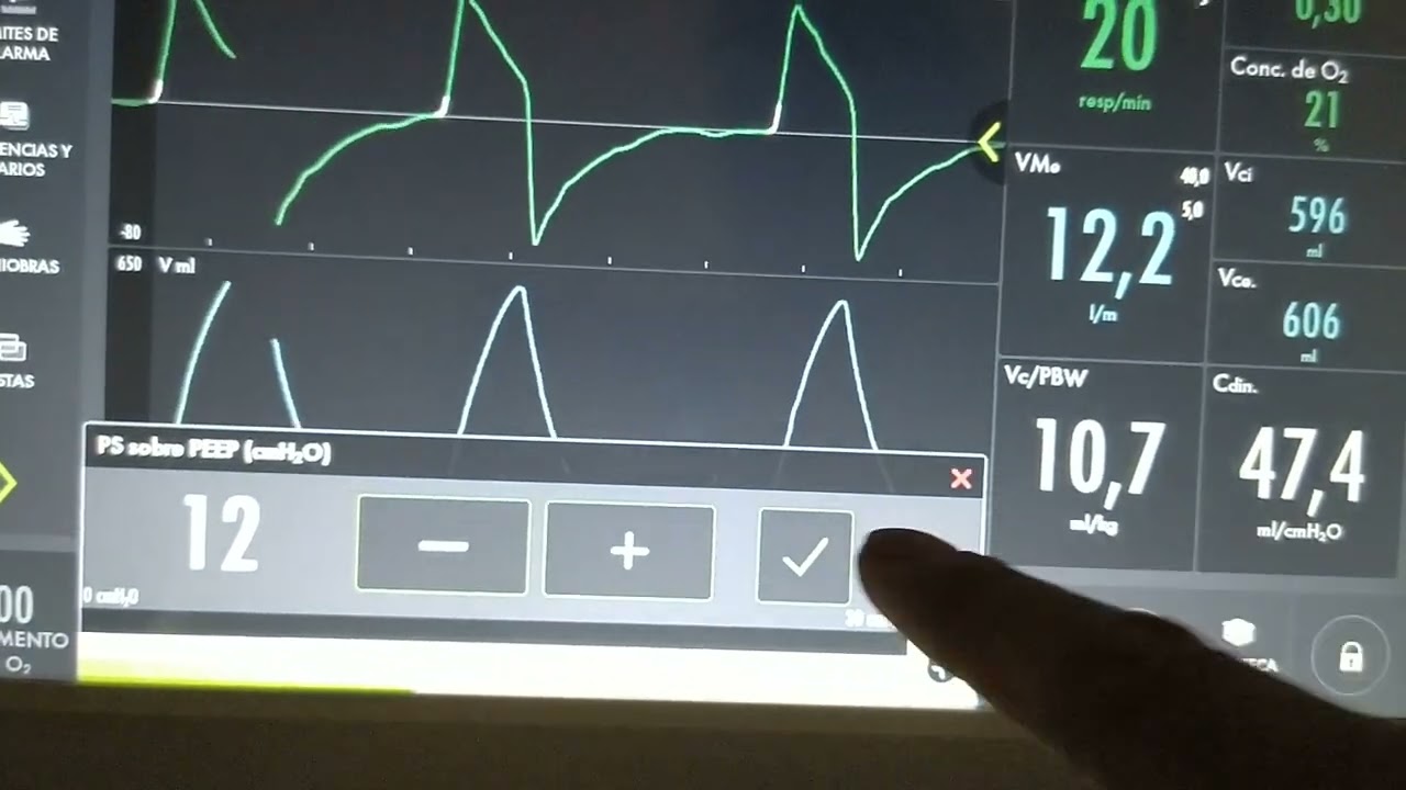 Modo ventilatorio: Espontáneo, CPAP, Presión Soporte. configuración