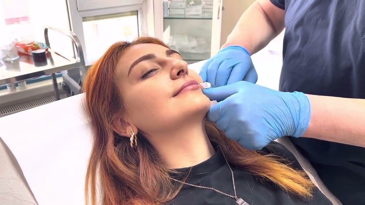 Dudak Dolgusu Yaptırdım | Tüm İşlemleri Çektim | Üst Dudağım Yoktu #dudakdolgusu #beauty
