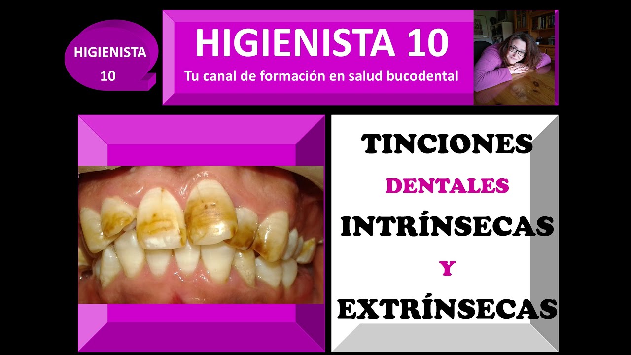 TINCIONES DENTALES INTRÍNSECAS Y EXTRÍNSECAS. TEMARIO GENERAL 20.