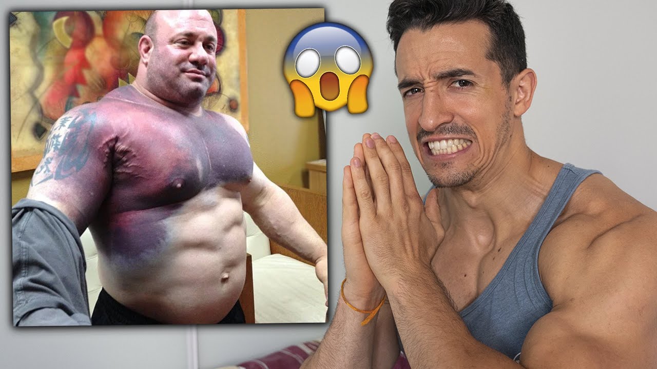 IL SE DÉCHIRE LE PEC !!