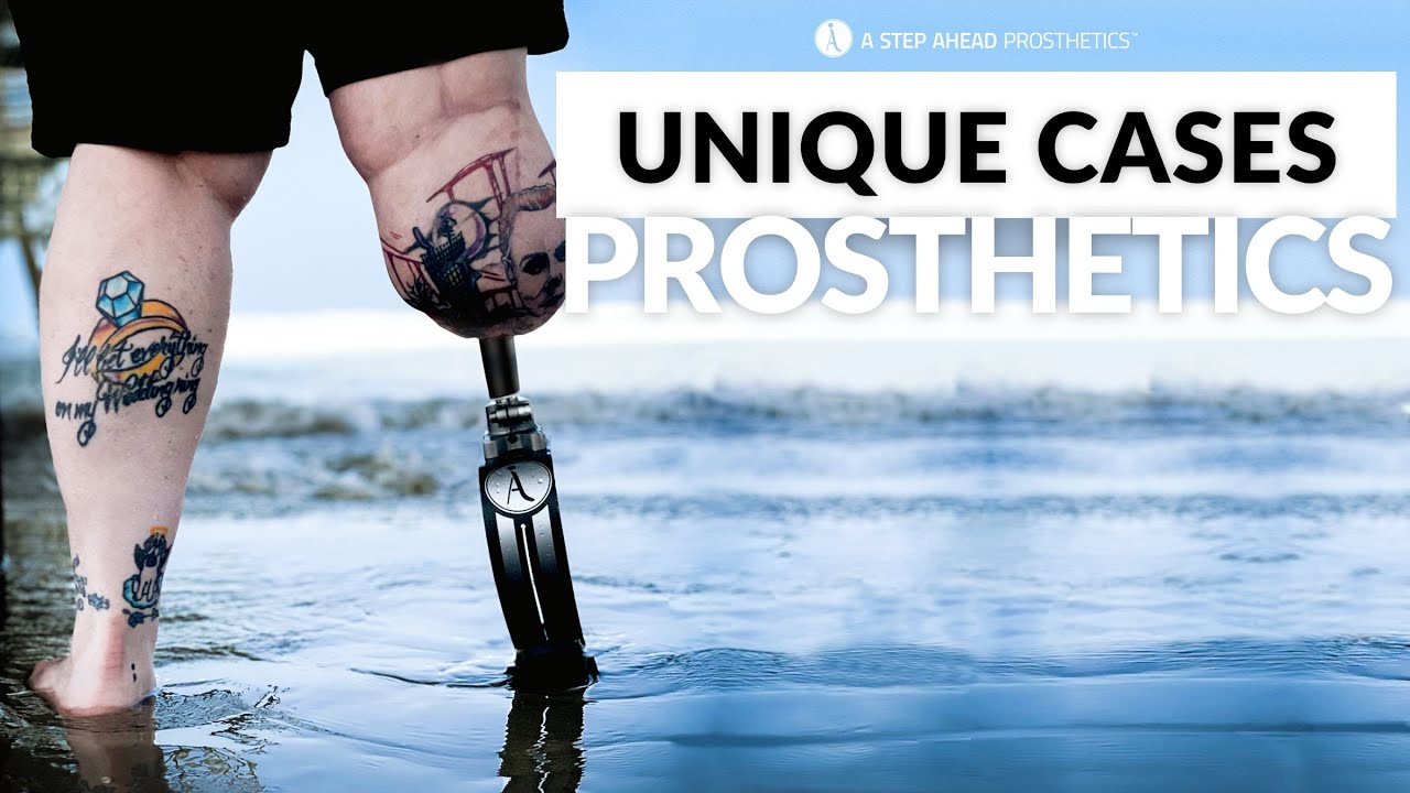 Custom Van Nes Rotationplasty Prosthetic Legs