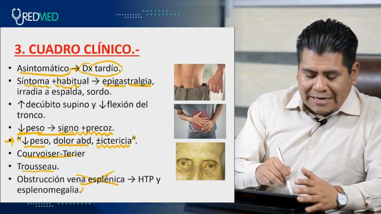 Tema 20 CIRUGIA Cáncer de páncreas