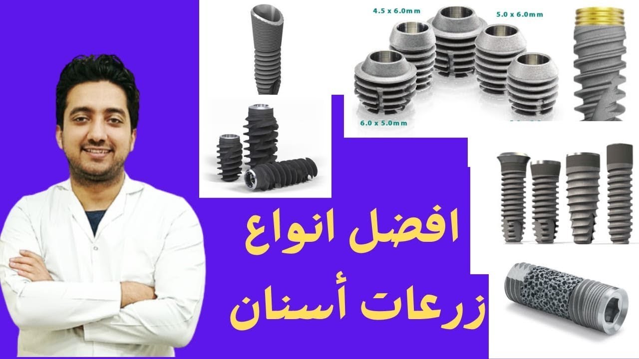 الرد علي اسئله المتابعين - أسعار زراعة الاسنان في مصر 2023 ؟؟ وايه هي أحسن زرعات أسنان؟؟