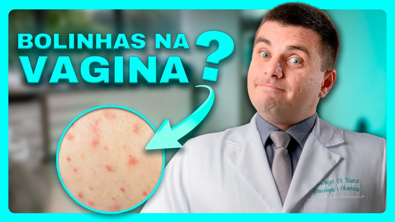 Verrugas, Cistos ou Pelo Encravado? Bolinhas na VAGINA sem p&acirc;nico!