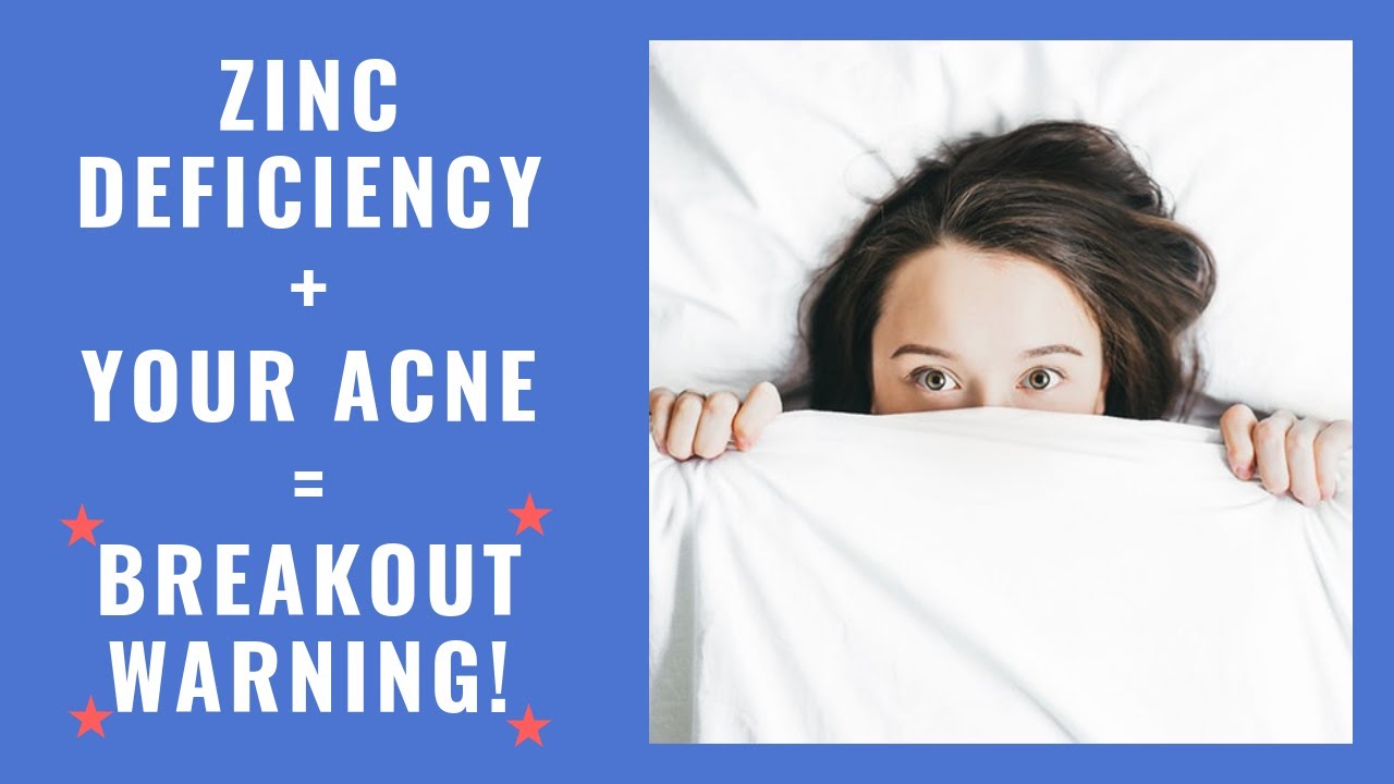 Acne zinc deficiency - breakout warning!