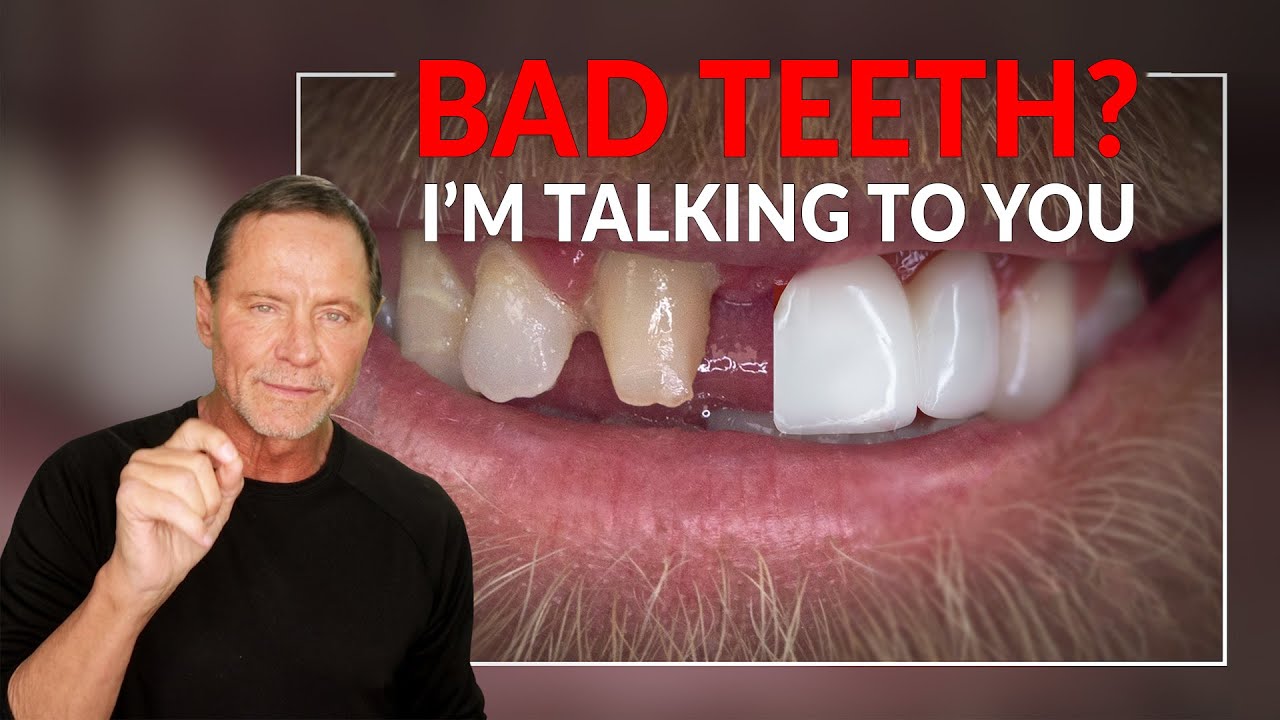 Bad Teeth Smile Makeovers: Confidence Boosting Results with before and after pictures.