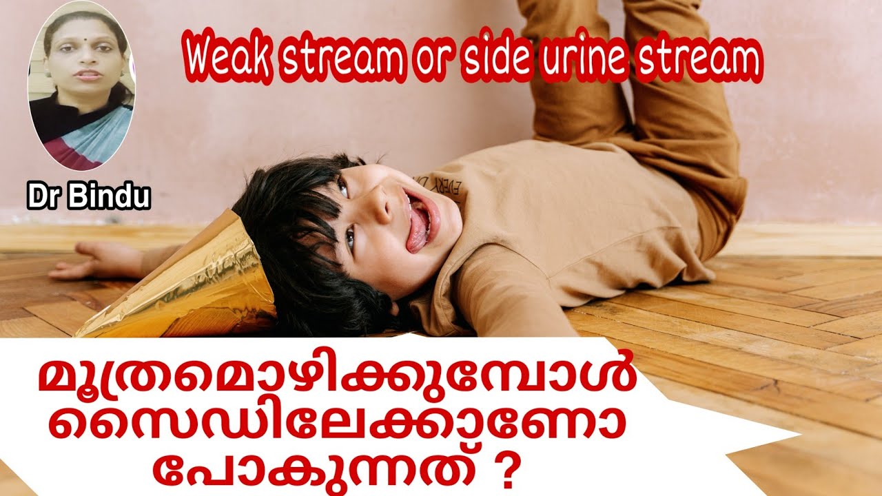 മൂത്രം സൈഡിലേക്ക് പോകുന്നു/Urine stream to one side/weak urine stream in boys
