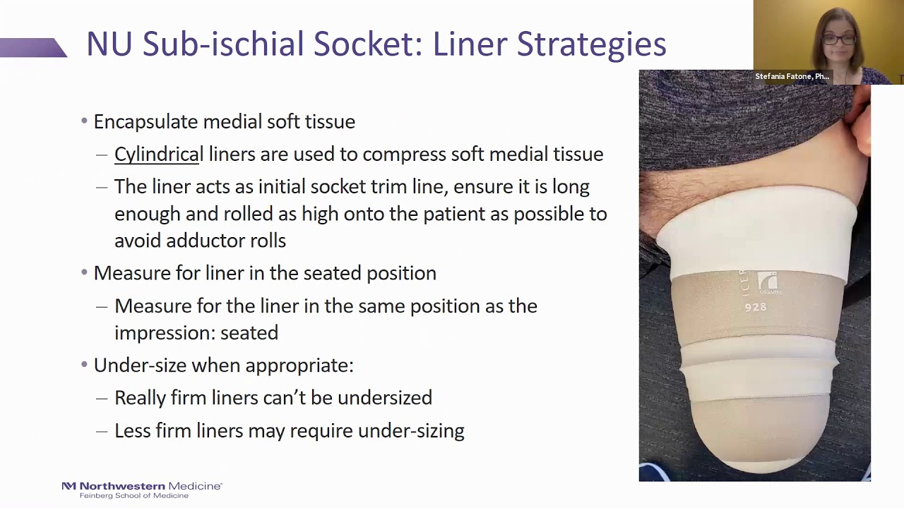 Transfemoral Socket Design: Overview of the Northwestern University Sub-ischial Socket Technique