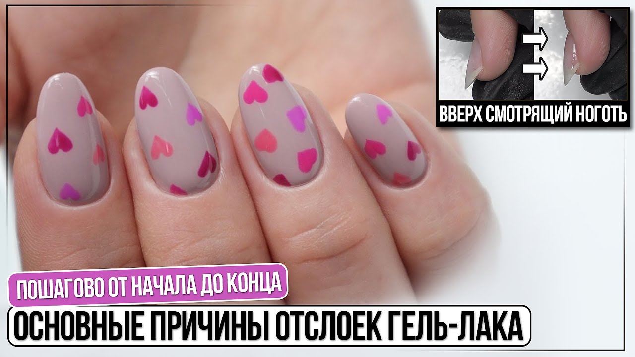 ОСНОВНЫЕ причины отслоек гель-лака пошагово ✅ Вверх смотрящий ноготь ✅ Ногти трамплины ✅ Сердечки