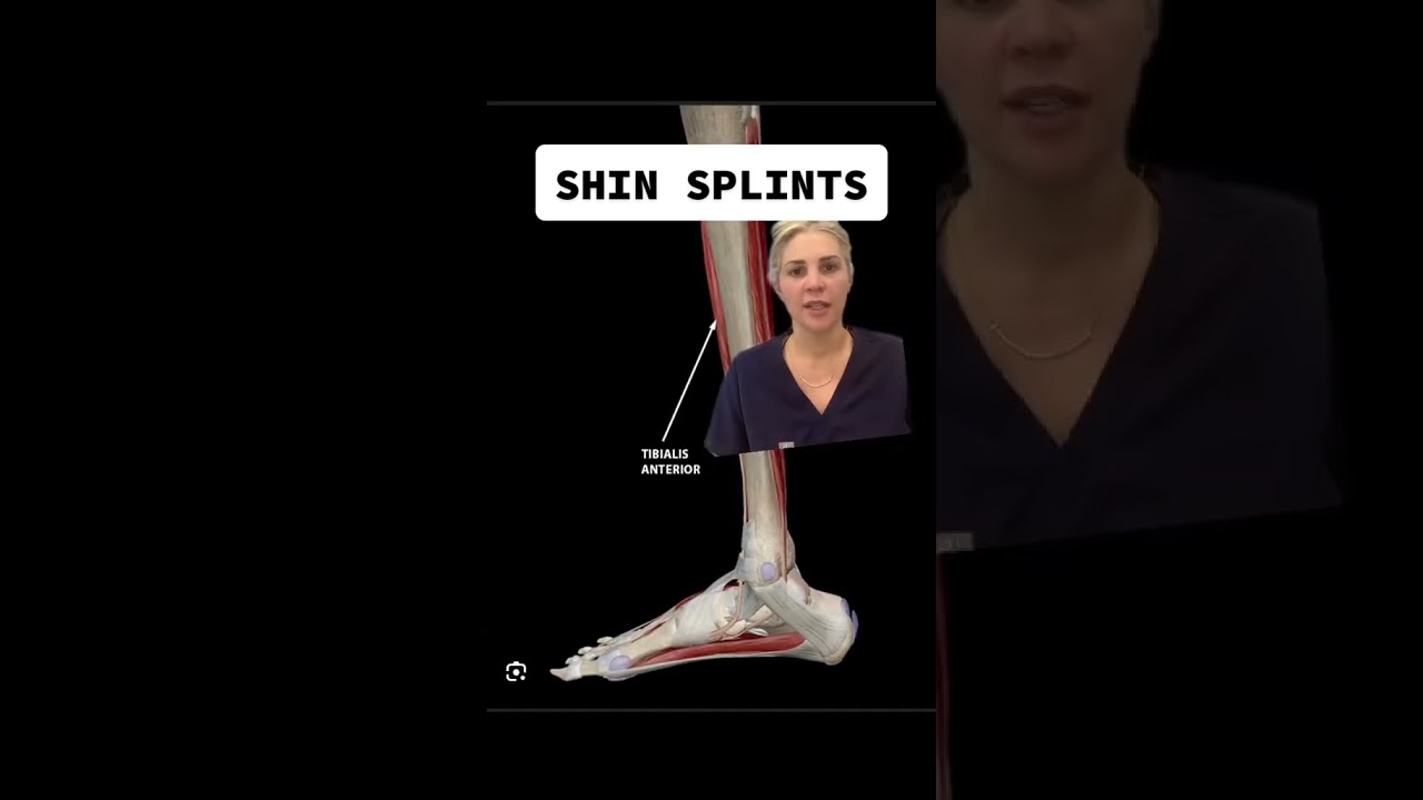 A Podiatrist Explains Shin Splints #shinsplints #footdoctor #running