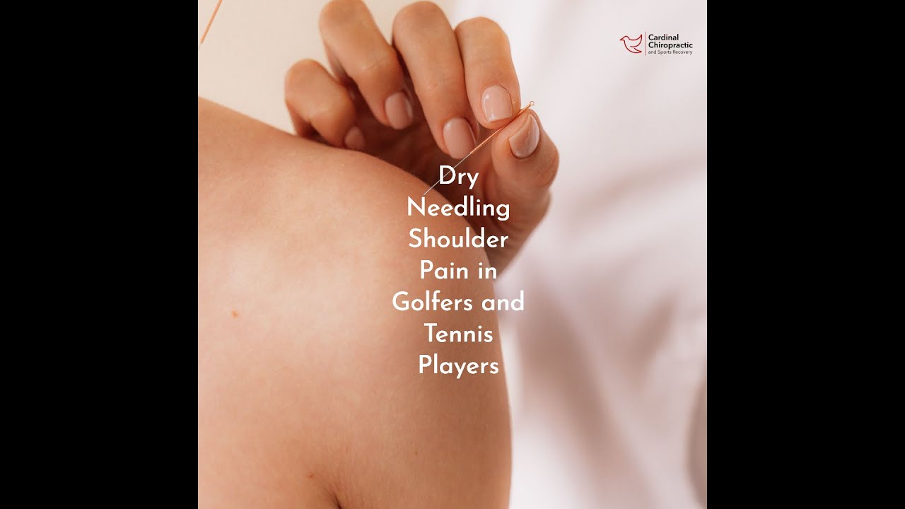 Dry Needling Shoulder Pain in Golfers and Tennis Players -Your Burlington NC Chiropractor