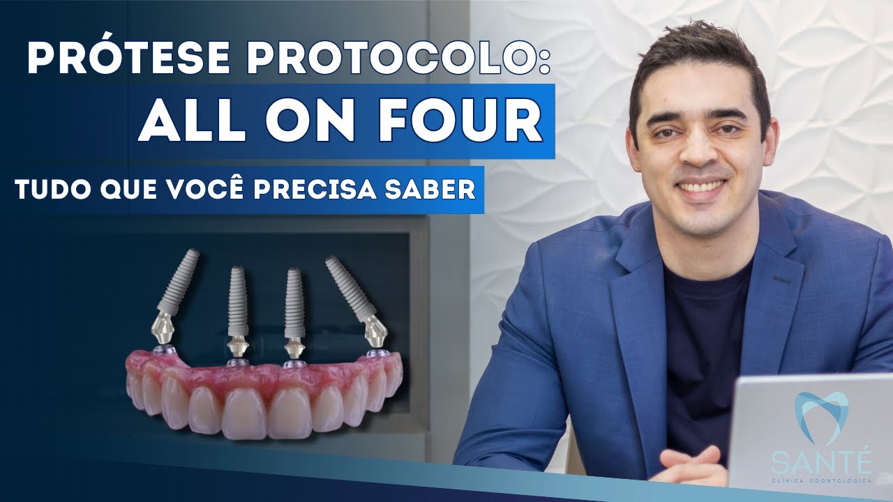 Prótese Protocolo - All on Four: Tudo que Você Precisa Saber | Carga Imediata