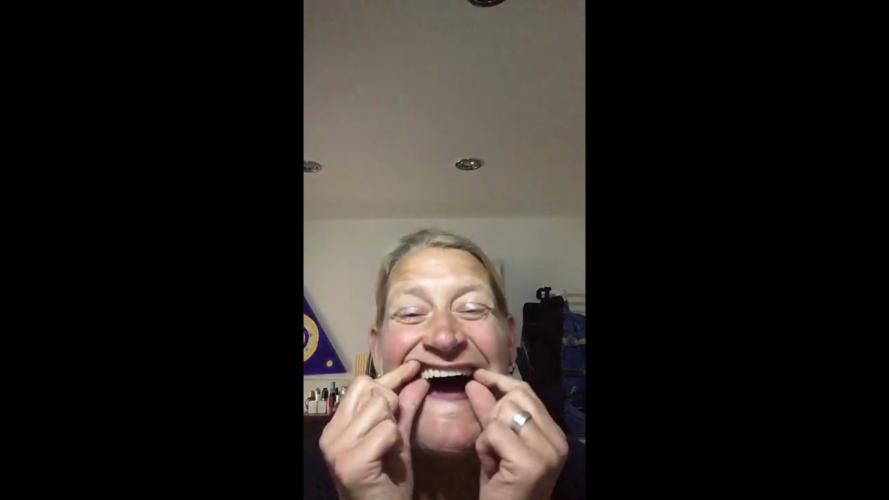 Vollprothese/ Dentures