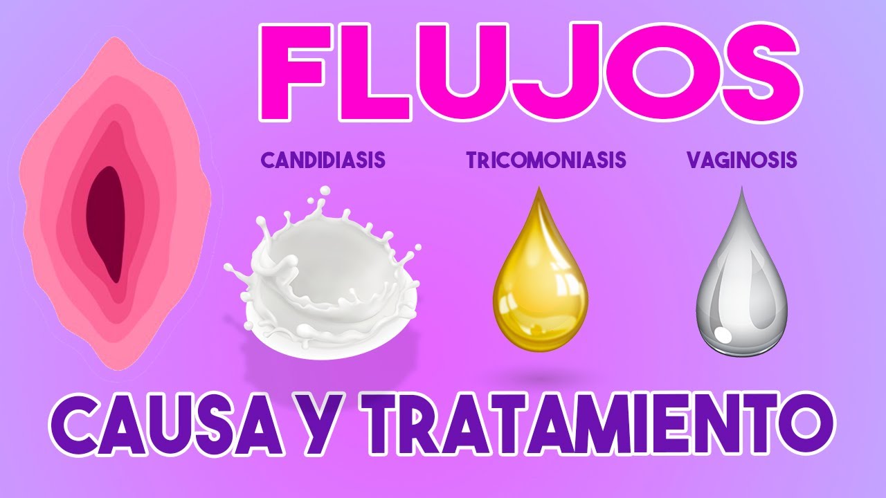 Como QUITAR el FLUJO VAGINAL