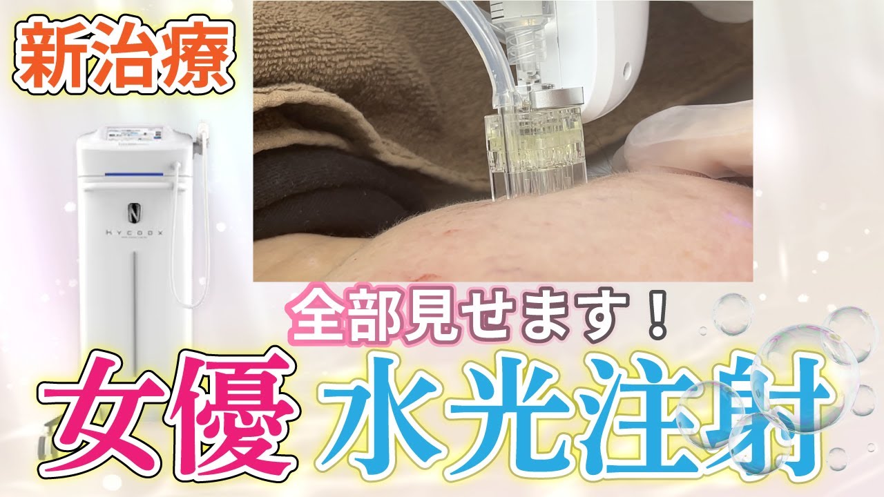 新治療！女優水光注射をスタッフがいち早く体験してみました！