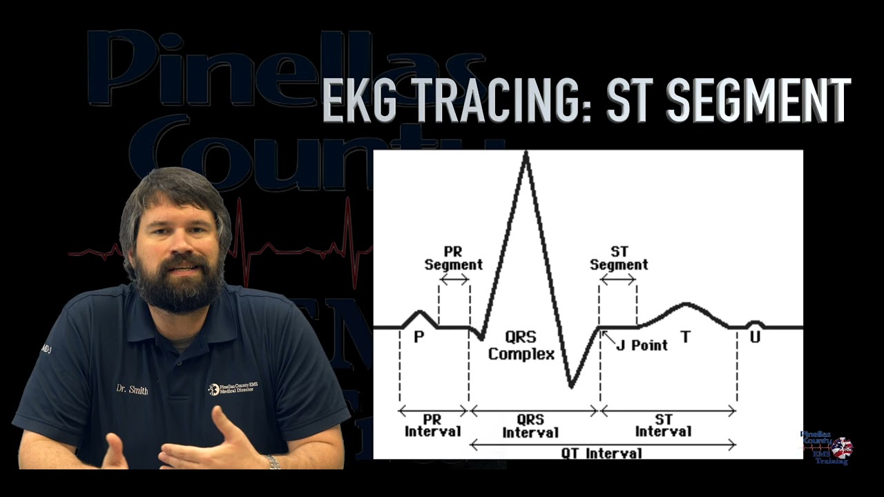 Deep Dive Cardiac conduction