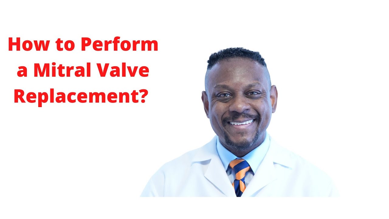 How to Perform a Mitral Valve Replacement?