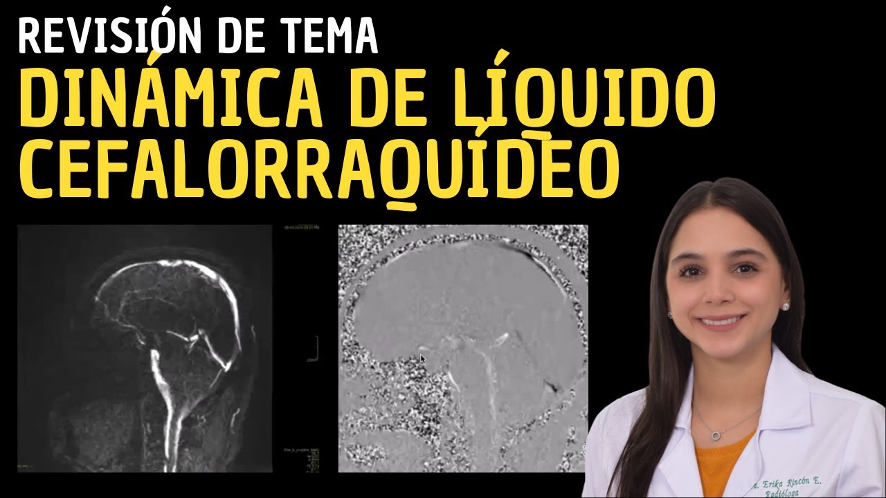 Dinámica de Líquido Cefalorraquídeo: Revisión de Tema.