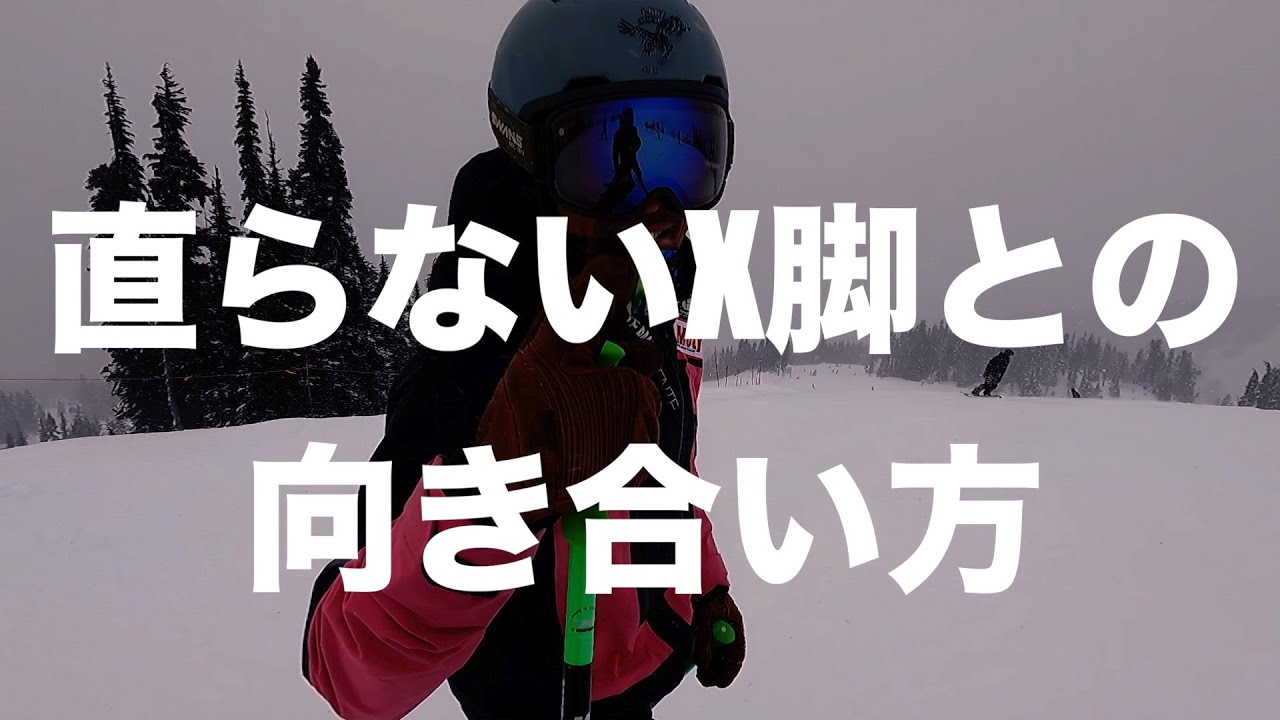 【直らないX脚の解説】しっかりと理解すればできます。