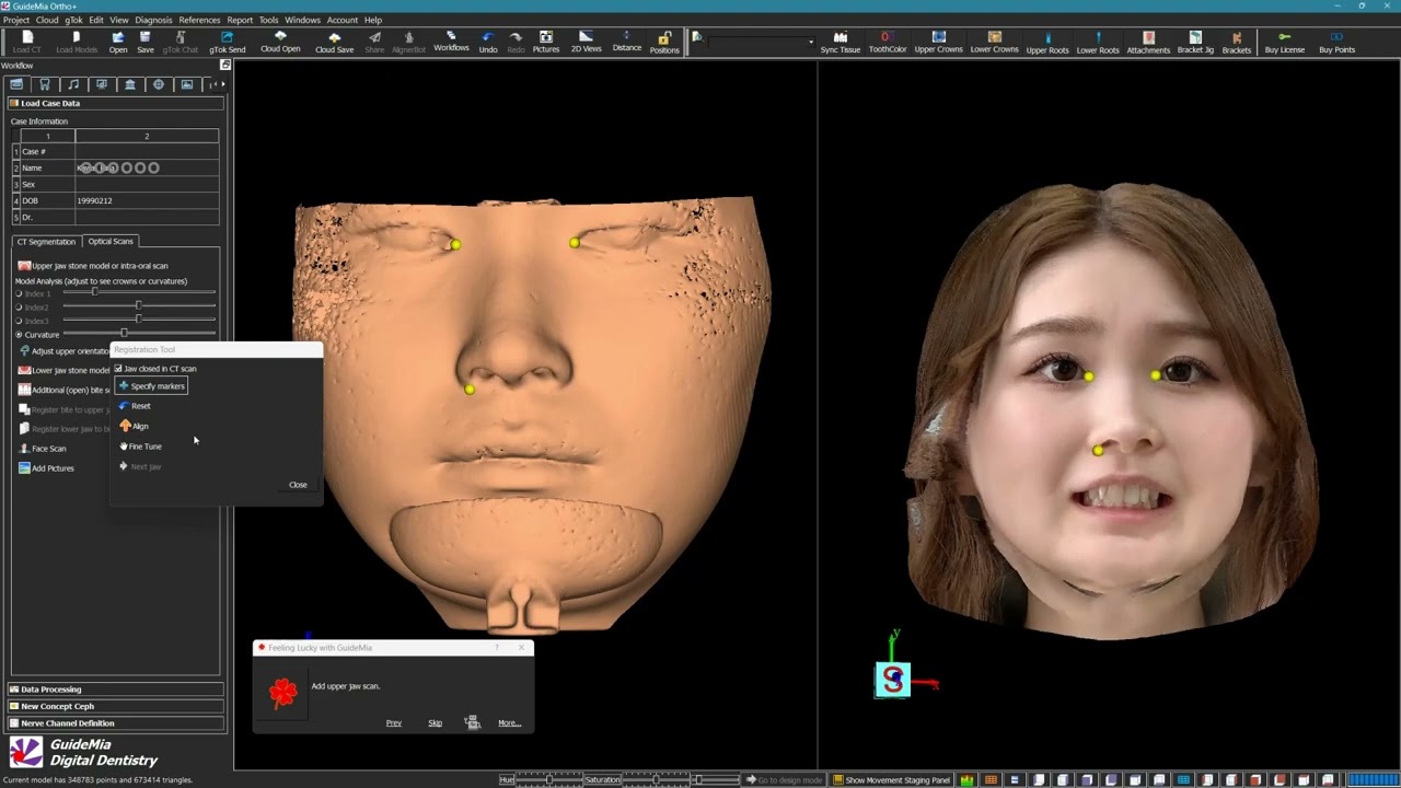 GuideMia Orthoplus  CT and FaceScan processing