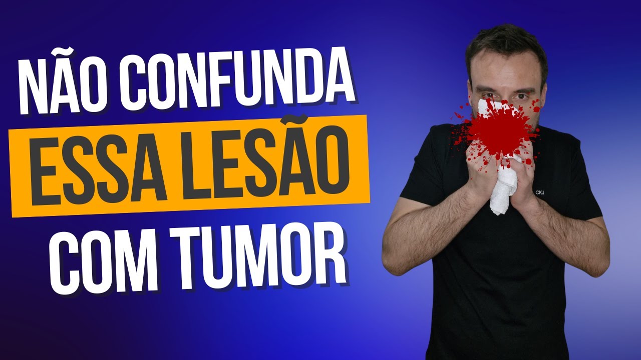 Não confunda essa lesão na tomografia de um paciente com epistaxe ou sangramento nasal