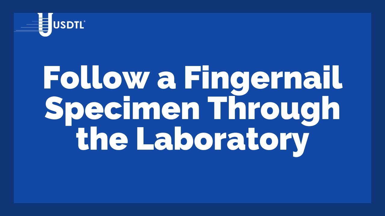 Following a Fingernail Specimen Through the USDTL Laboratory