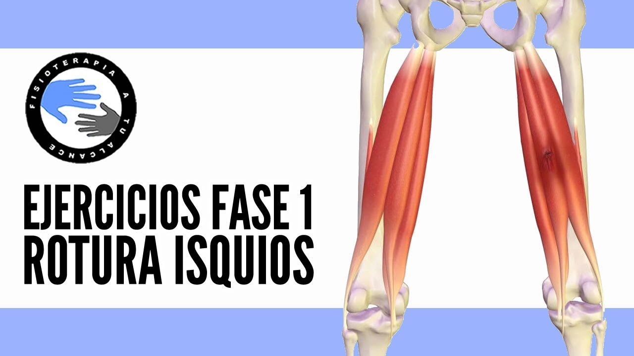 Rotura fibrilar de los isquiotibiales, ejercicios y tratamiento para la fase 1